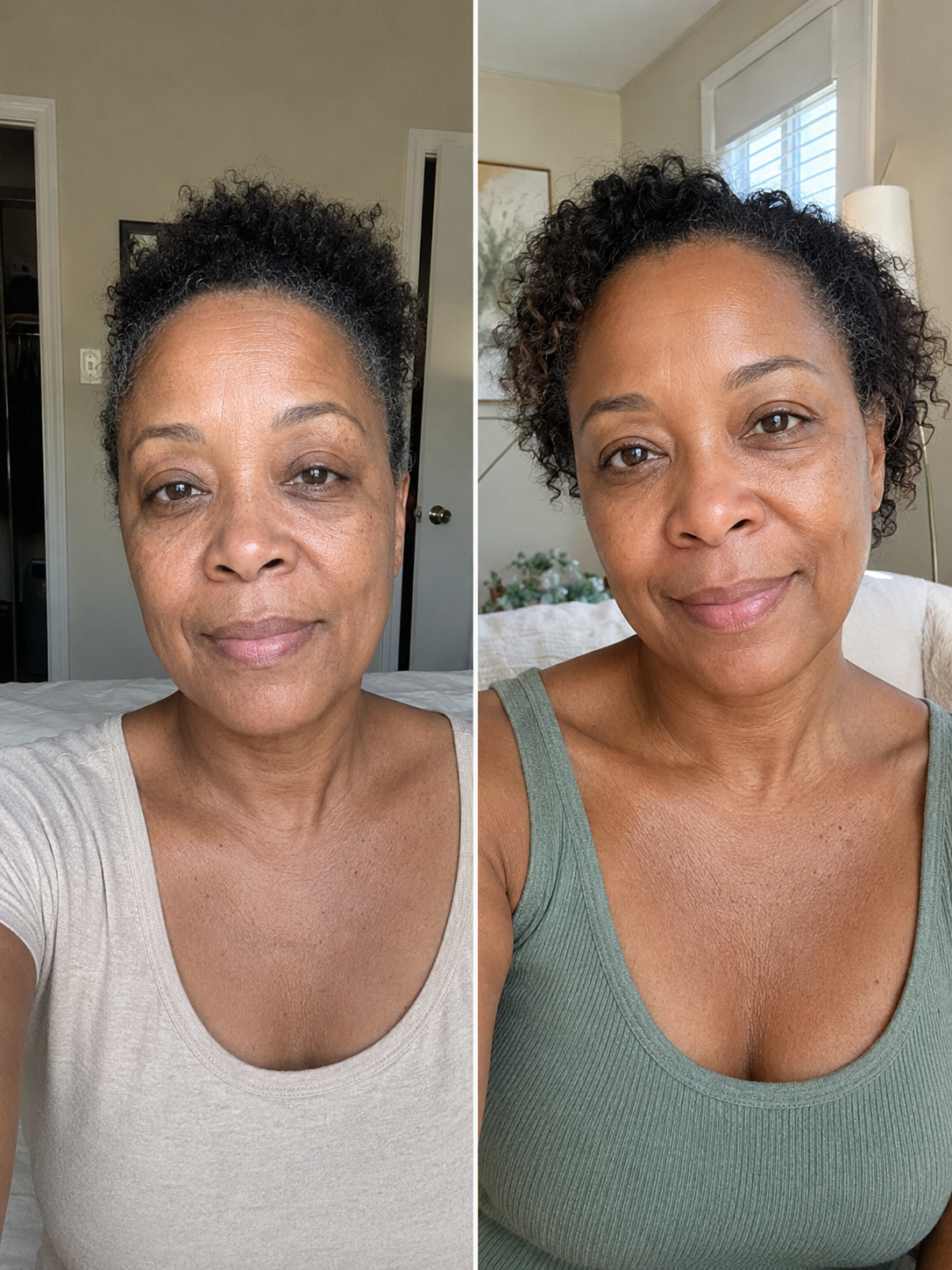 Before and after — Rhonda