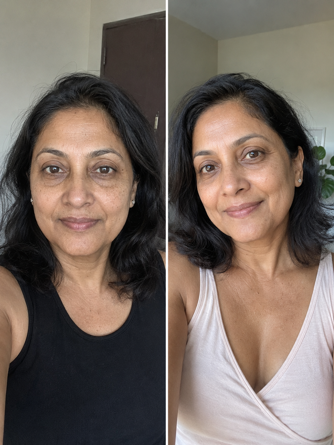 Before and after — Avani