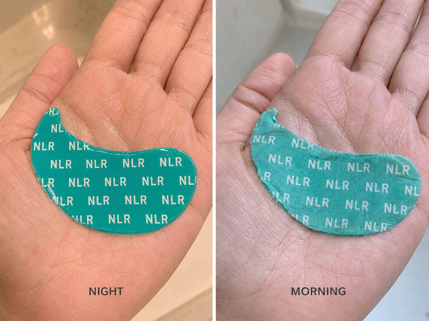 Patch saturated with serum at night vs nearly empty in the morning